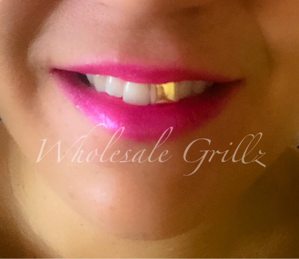 NEW! 14K Gold Plated SINGLE Front TOOTH Cap! Upper Central INCISOR